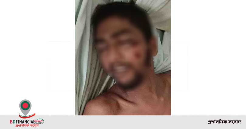 বাগেরহাটে সড়ক দূর্ঘটনায় অজ্ঞাতনামা মানসিক রোগী যুবক নিহত